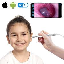 WiFi Otoscope